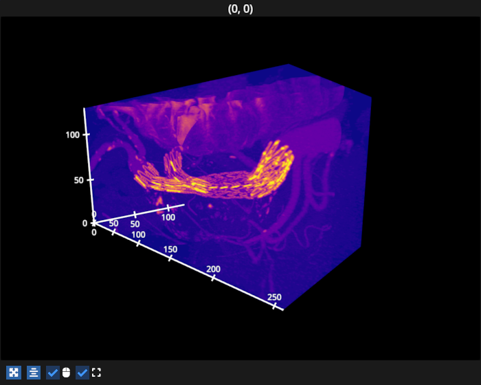 image volume mip
